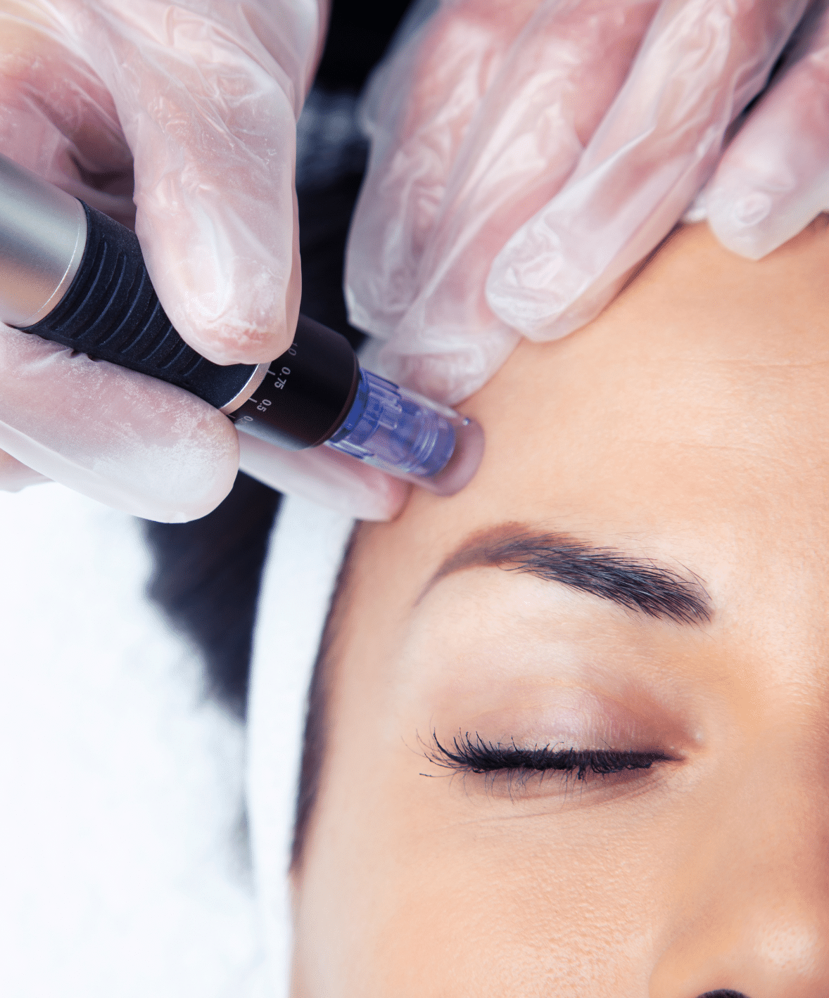 Dermapen con activos | 60min